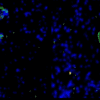 Organoidi di vasi sanguigni, sul cuore come cerotti – Biotech