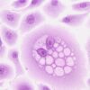 Cellule che si muovono in gruppo punto debole del tumore al seno – Biotech