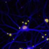Un farmaco contro le lesioni spinali efficace anche contro l’Alzheimer – Biotech